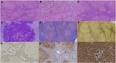 Neonatal sclerosing cholangitis with novel mutations in DCDC2 (doublecortin domain-containing protein 2) in Chinese children